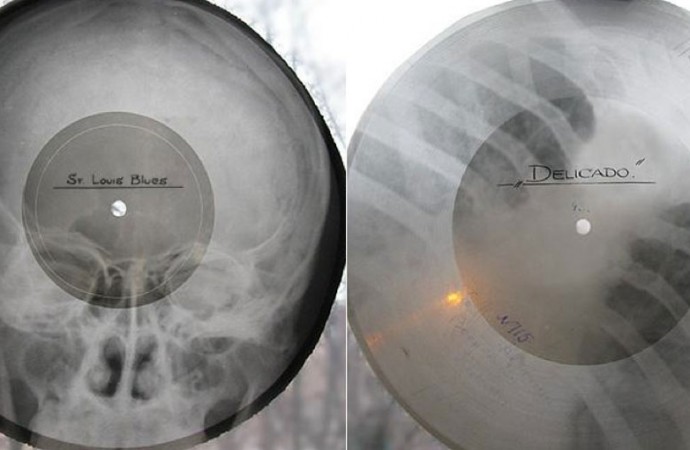 Communism, X-ray discs and music
